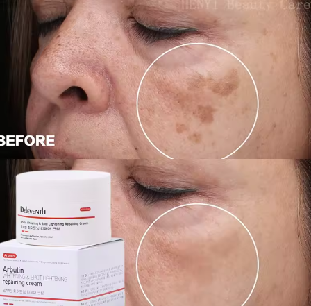 High Quality Korean Face Cream Skin Care Products Skin Whitening Brightening Moisturizer Lightening Facial Rejuvenating Cream